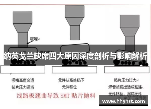纳英戈兰缺席四大原因深度剖析与影响解析